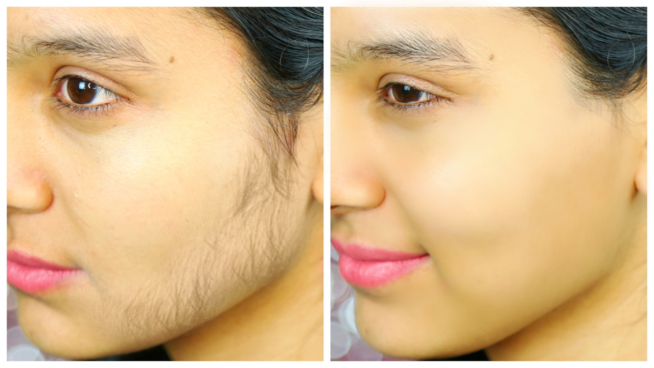चेहरे के बाल हटाने के उपाय how to remove face hair in hindi