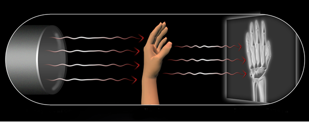 x-rays in hindi